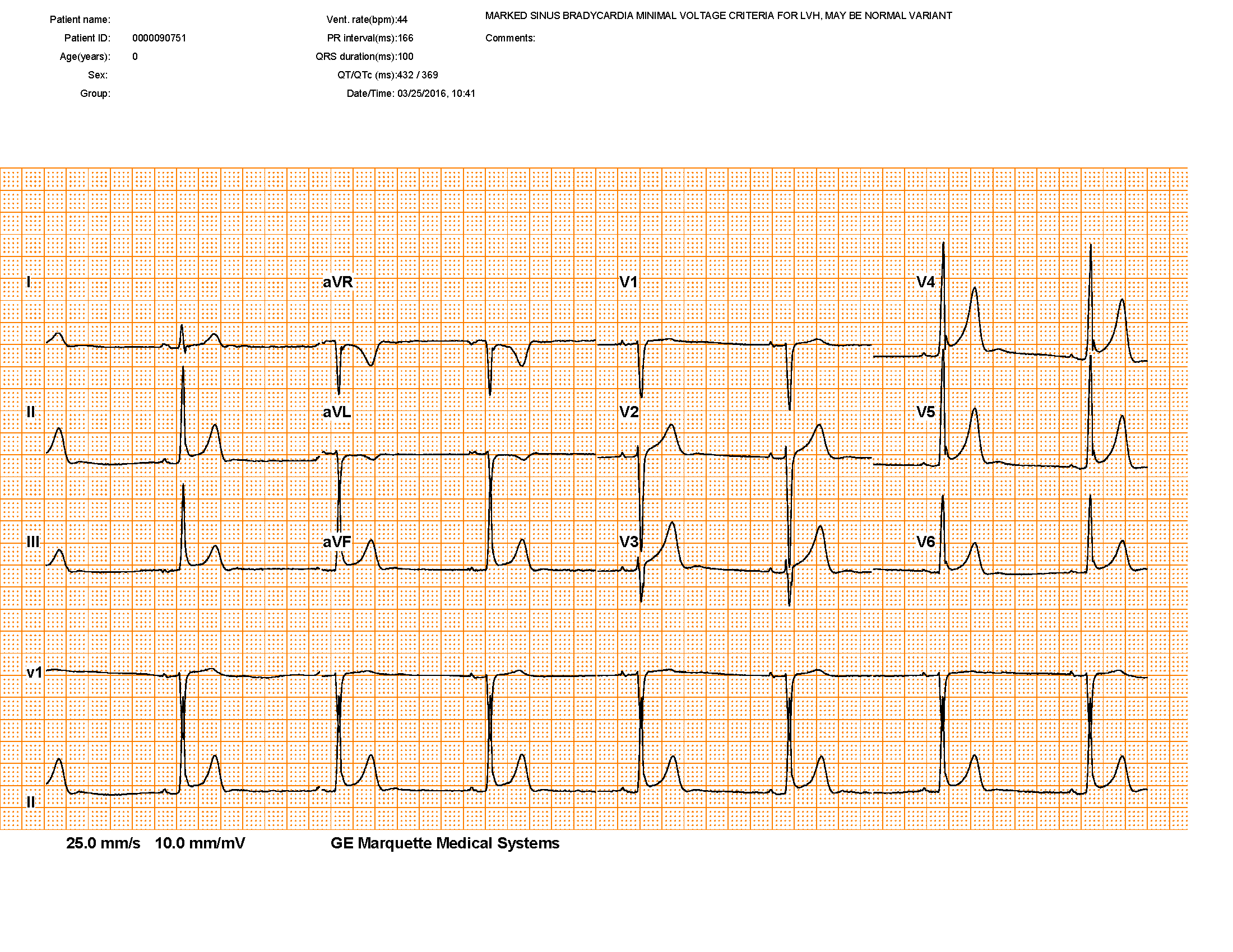 Papel ECG: Um aplicativo de código aberto para digitalizar verificações de imagem ECG